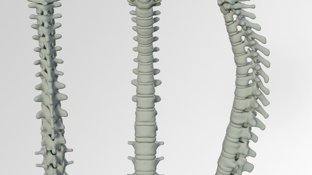 spine, bone, back pain-3220105.jpg